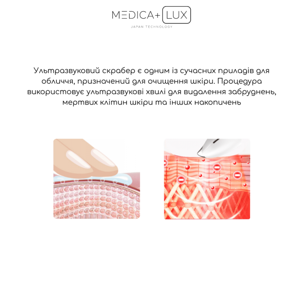 Ультразвуковой скрабер MEDICA+ Lux SuperSonic 10 (Japan)