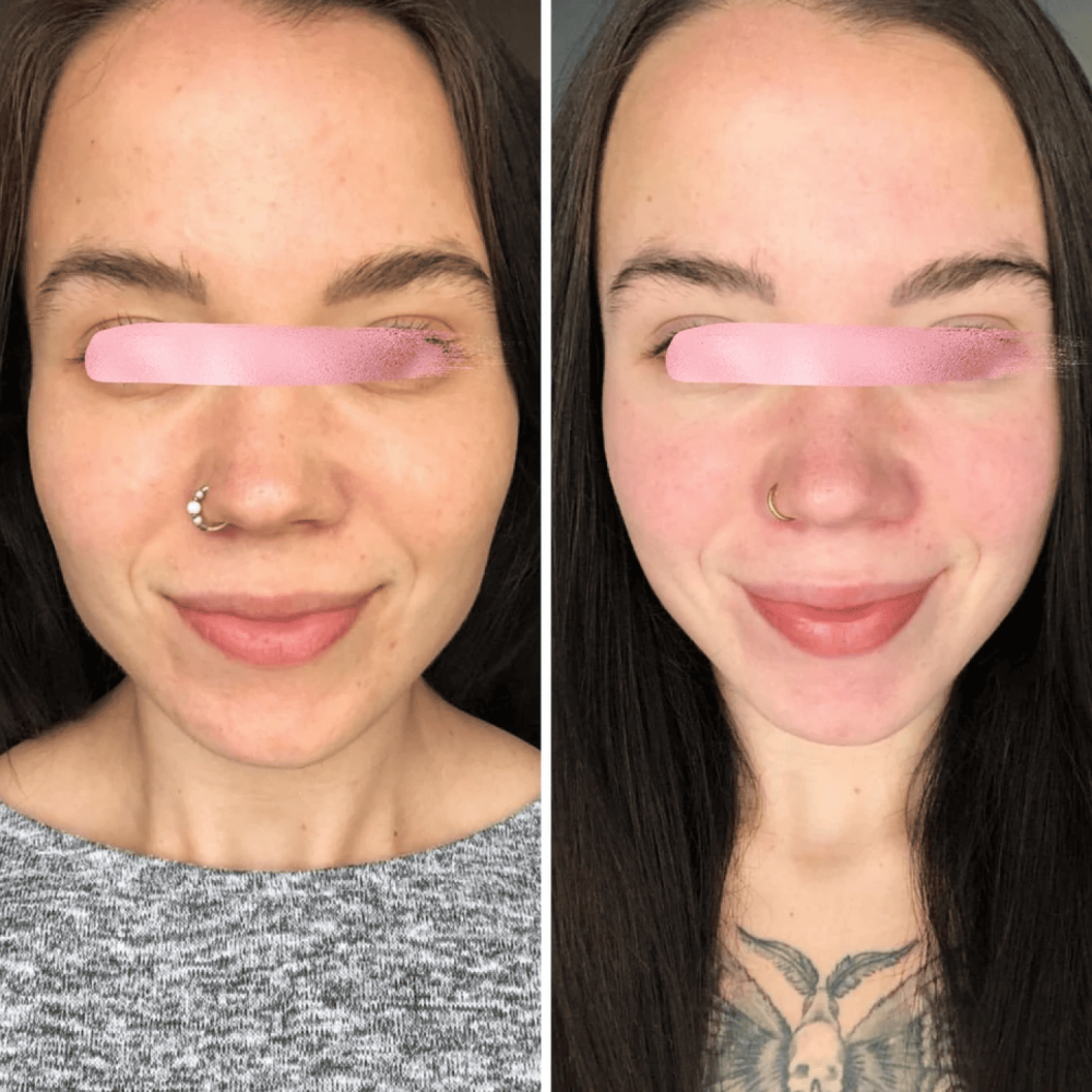 Микротоковый лифтинг MEDICA+ Skin Lifting 6.0 pink (Japan)