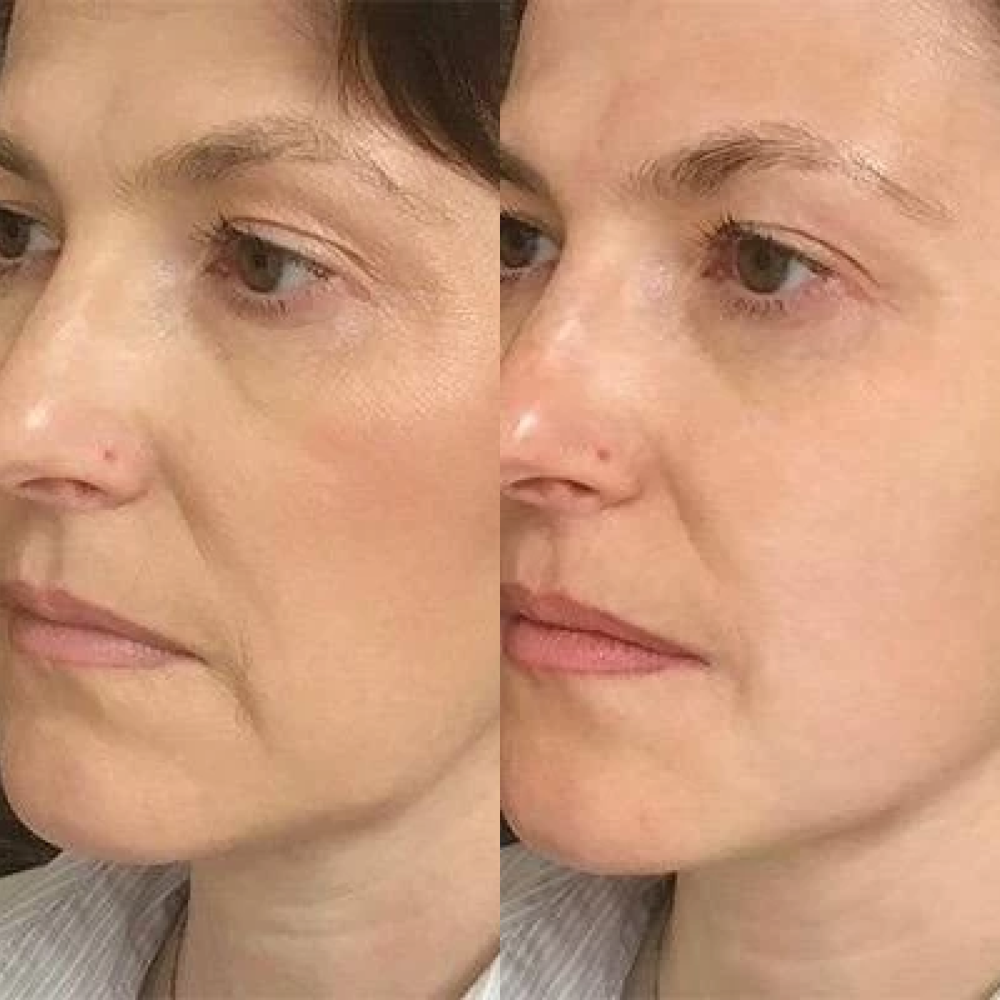 Поросуживающая маска для лица MEDICA+ Pore Control Mask (50 мл)