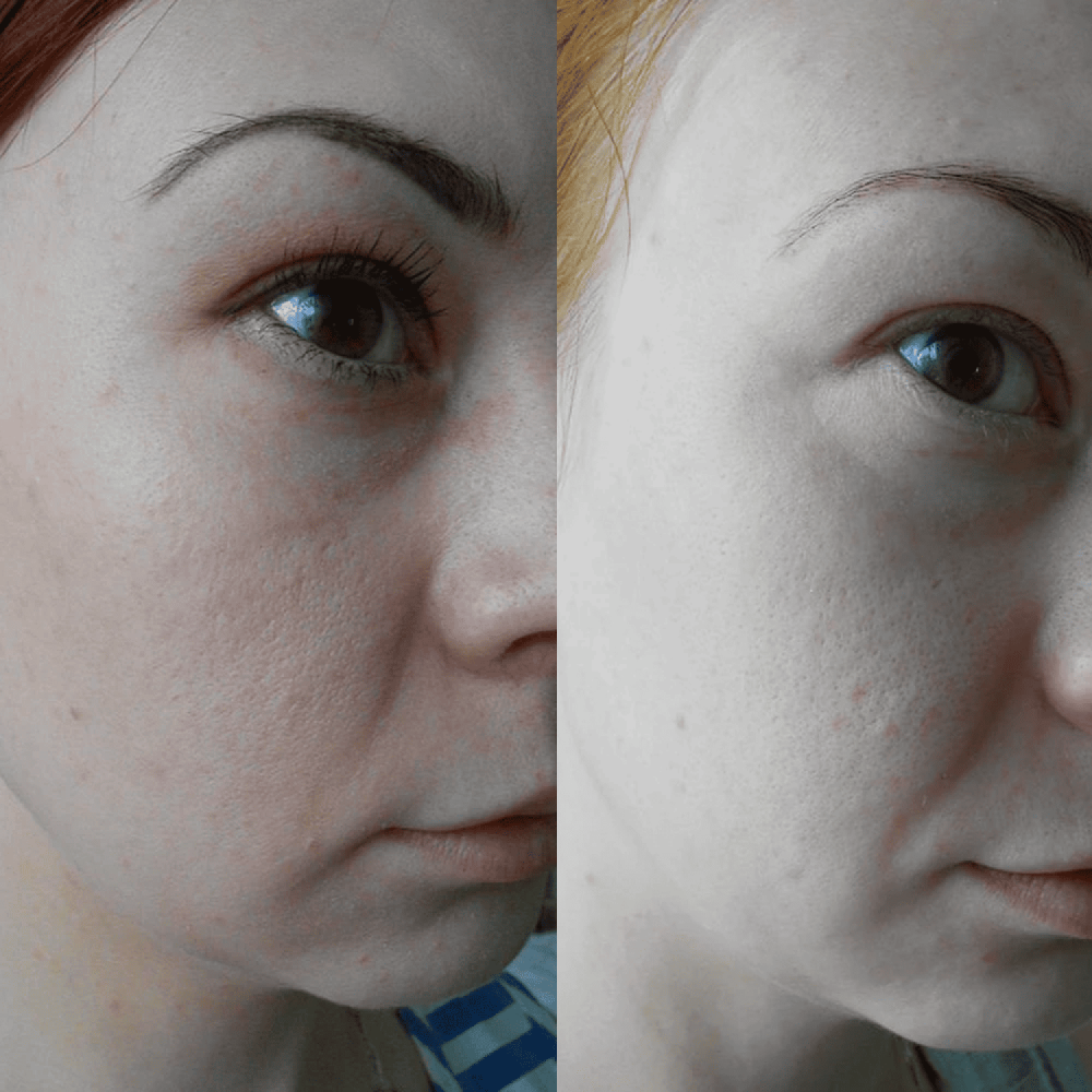 Суспензия MEDICA+ Antibacterial suspension (100 мл)