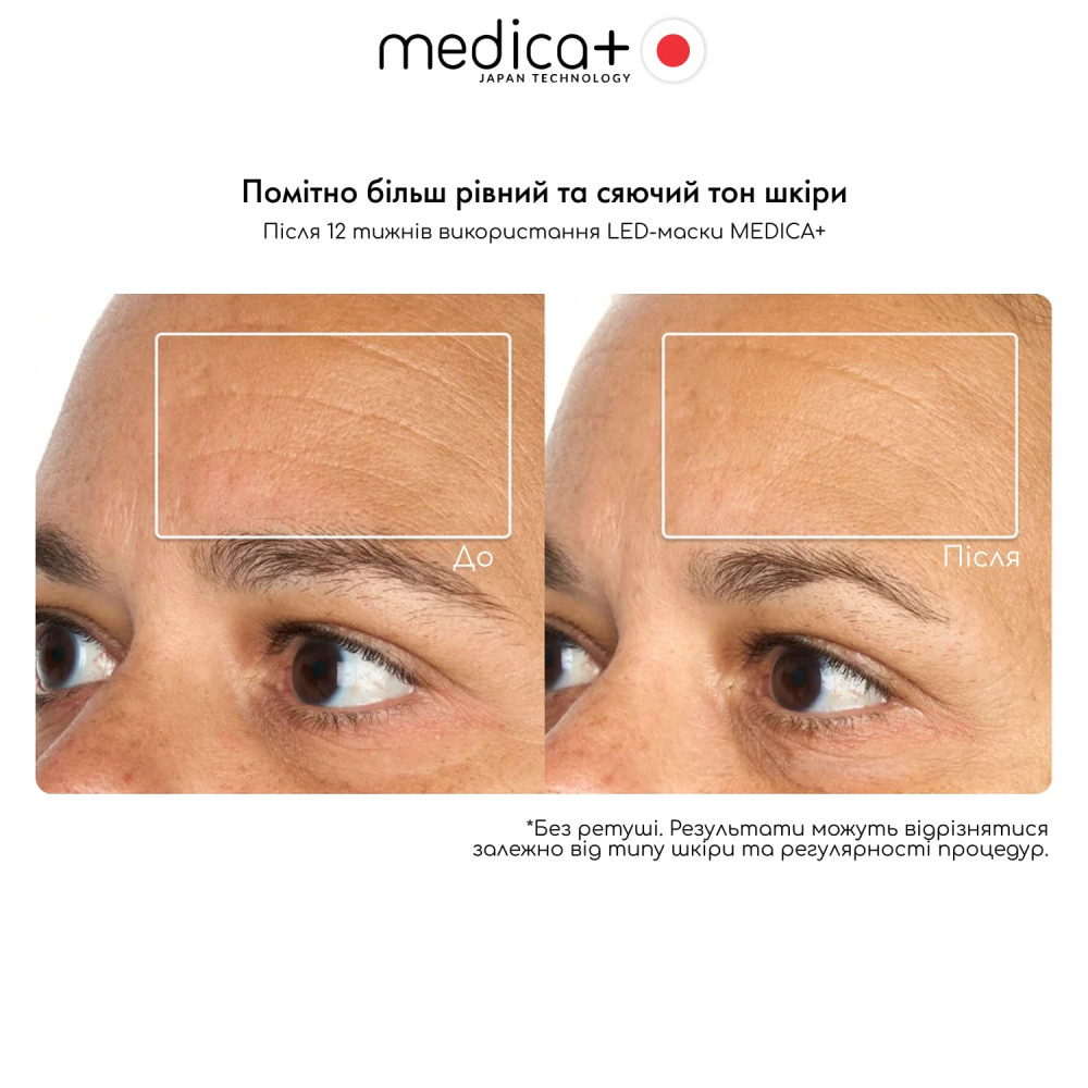 LED-маска для светотерапии MEDICA+ LEDMask 8X (Japan)