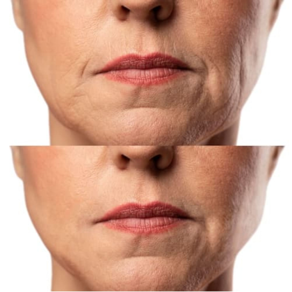Набор Микротоковый RF Lifting Массажер для лица Skin Lifting 7.0 White + Токопроводящий гель + Успокаивающая маска для лица MEDICA+ (Japan)