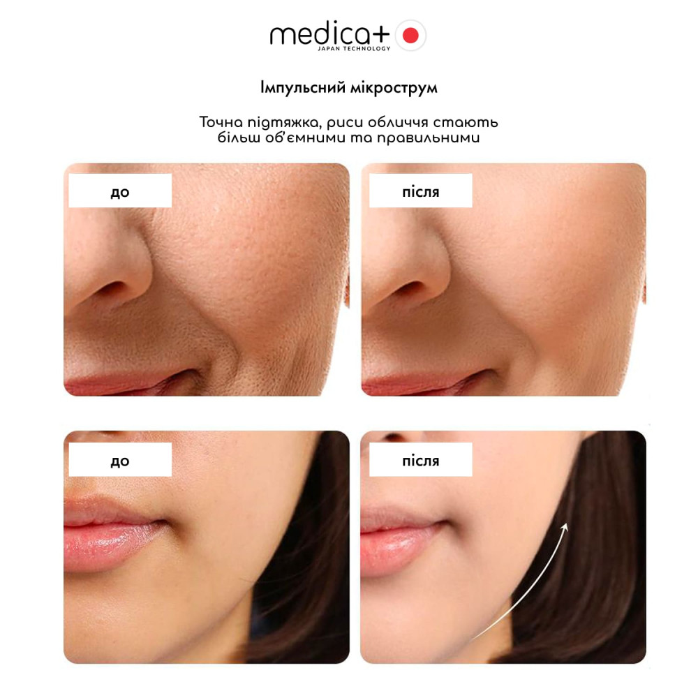 Массажер для лица MEDICA+ SkinLifting PRO 10x с микротоками, RF и функцией лифтинга (Japan)