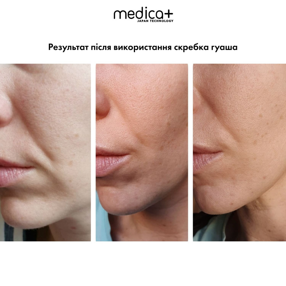 Стальной скребок гуаша для моделирования овала лица MEDICA+ Steel GuaSha