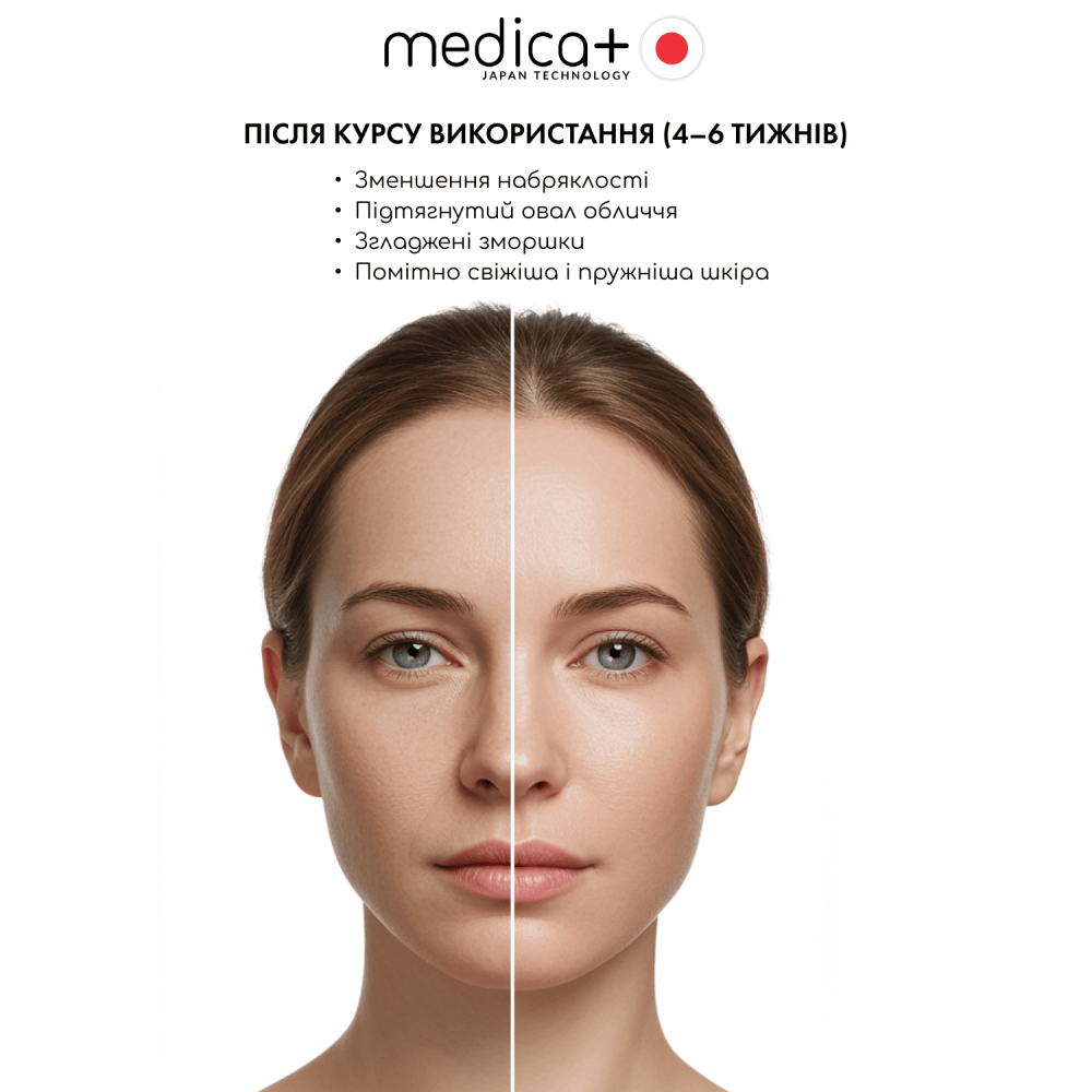 Микротоковый лифтинг массажер для лица MEDICA+ Tri-Action 8.0 (Japan)