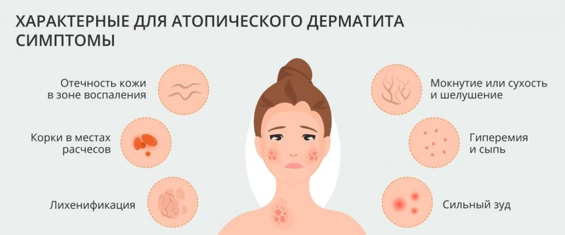 лечение себореи